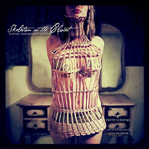 cover image Skeleton in the Closet: Eating Disordered Lives 